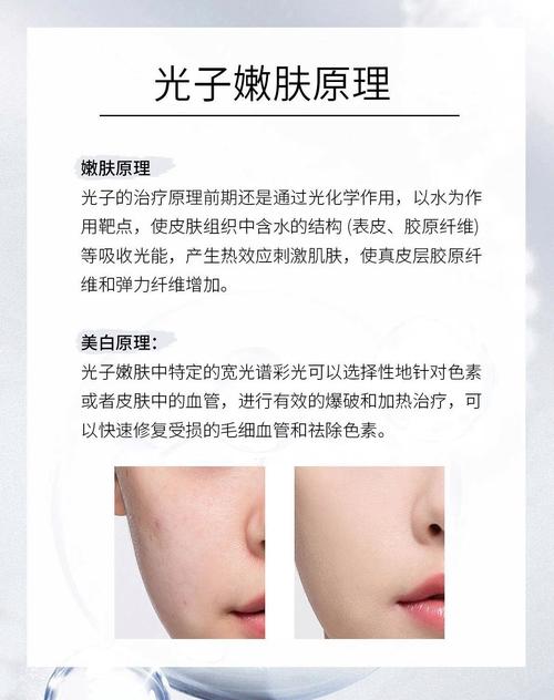 什么可以嫩肤
