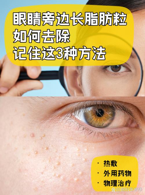 为什么要长脂肪粒