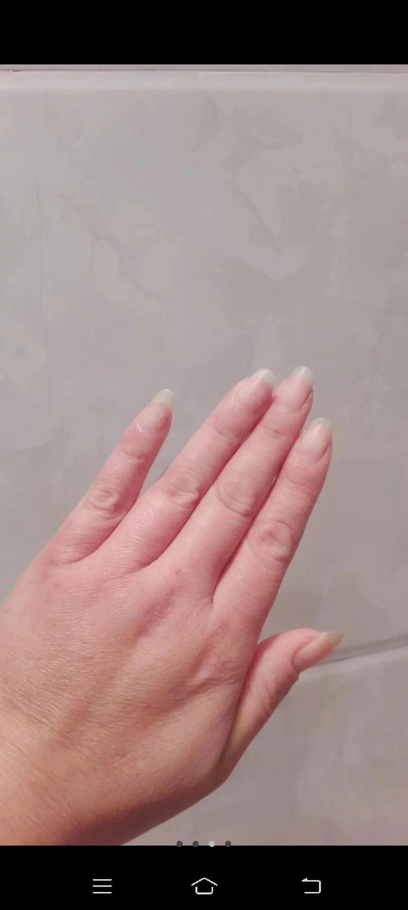 手冻了为什么会痒