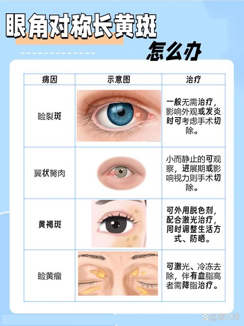 眼角有斑是什么原因
