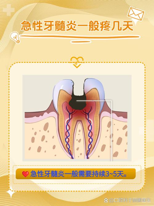 牙髓炎是什么意思