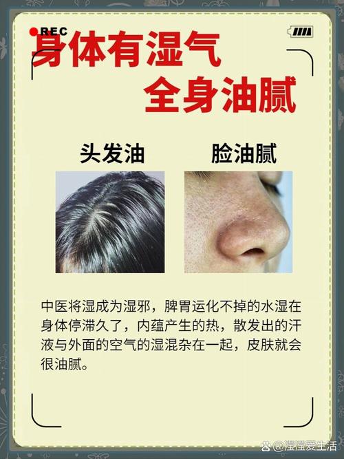 头发油多什么原因