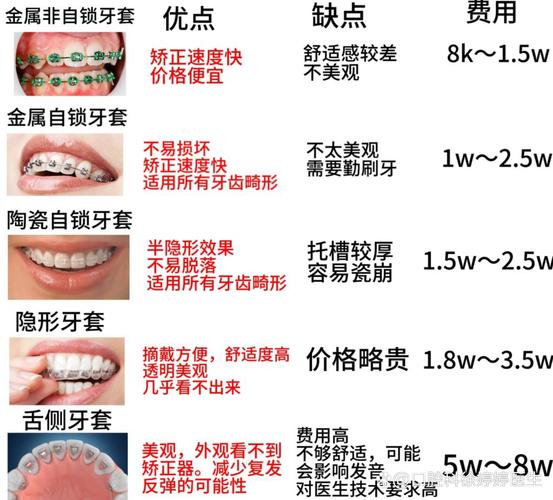 整牙为什么那么贵
