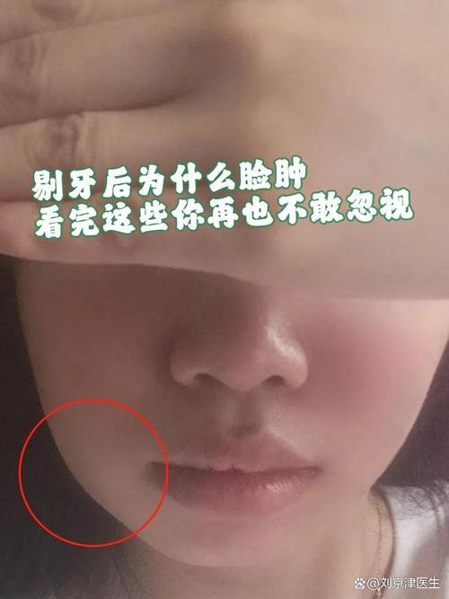 牙疼为什么脸会肿