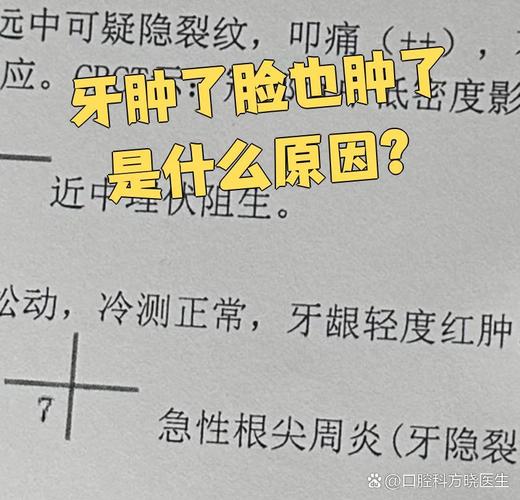 牙疼为什么脸会肿