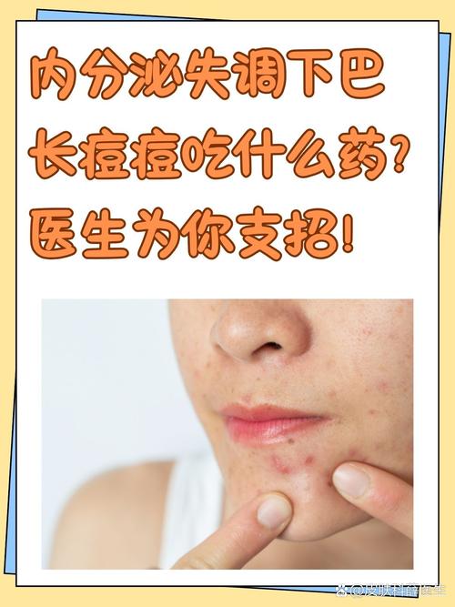 下巴长痘痘吃什么好