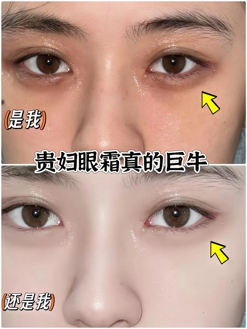 为什么眼霜那么贵