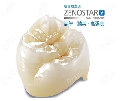 全瓷牙什么牌子好