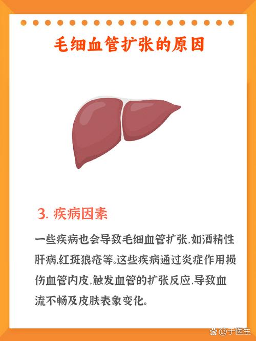 血管扩张有什么危害