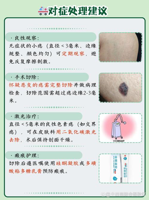 大腿有痣代表什么意思