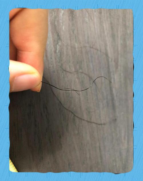 头发易断是什么原因