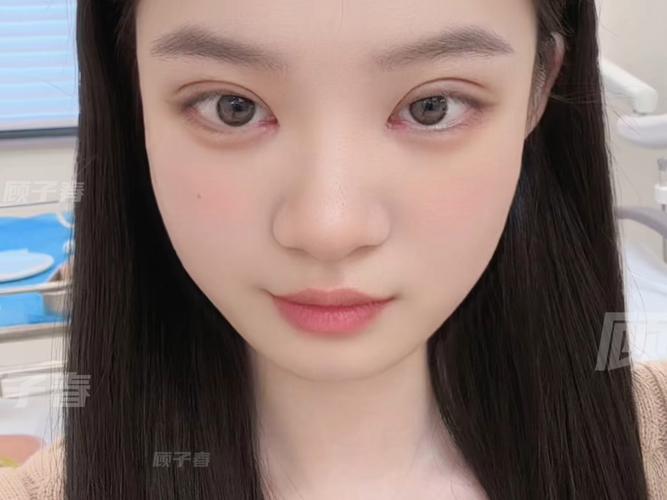 圆眼适合什么双眼皮
