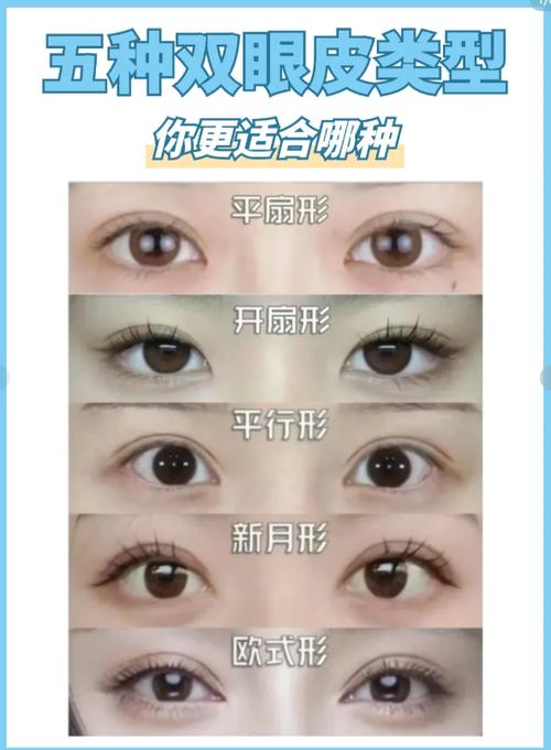 圆眼适合什么双眼皮