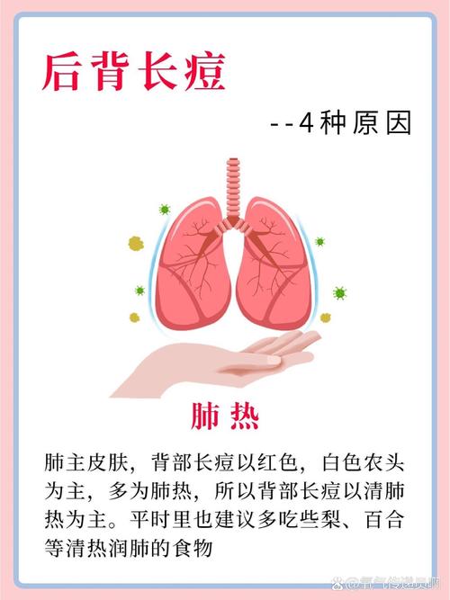 身上长痘痘是什么病