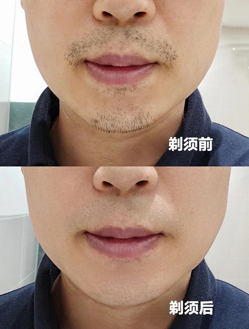 男生什么时候刮胡子