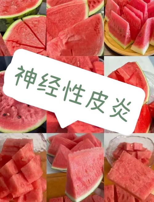 皮炎不可以吃什么