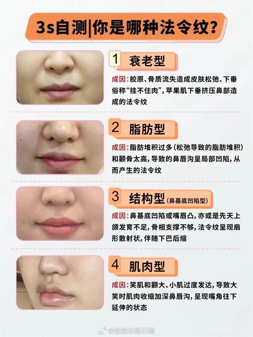 面部凹陷是什么原因