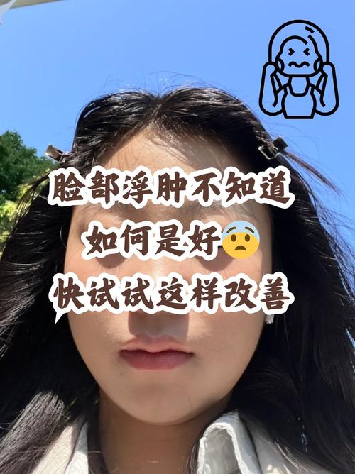 为什么脸容易水肿