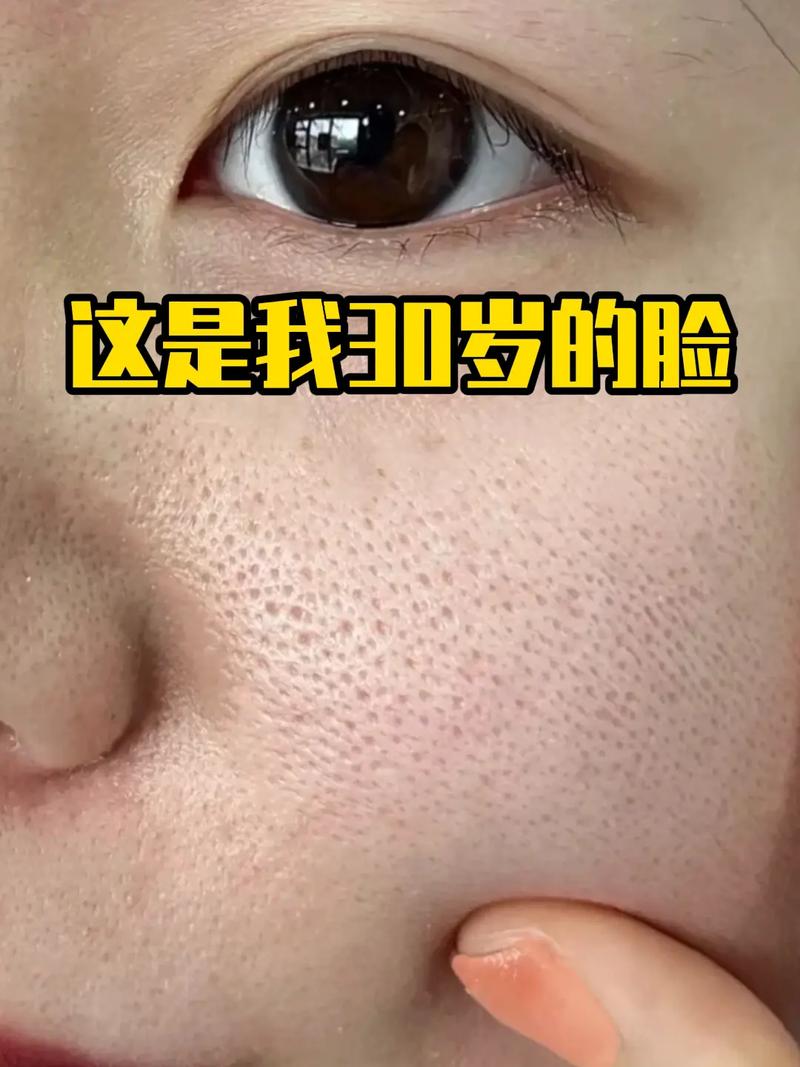 用完洗面奶脸上长痘痘怎么回事