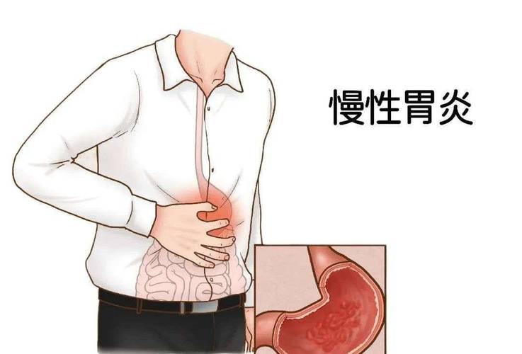 胃凉有什么症状