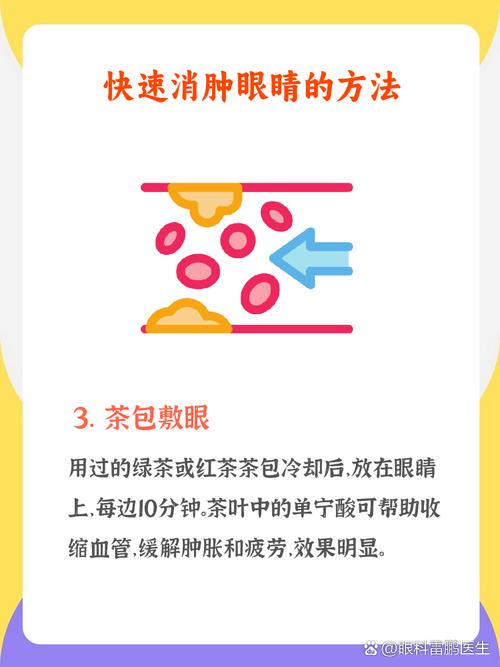 敷什么消肿