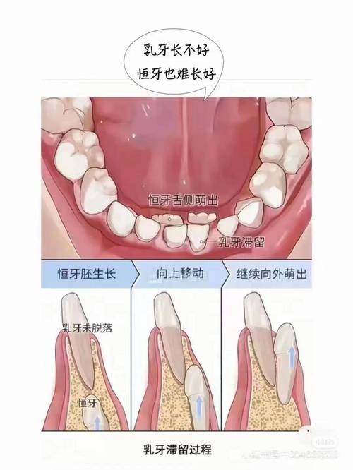 牙齿最里面的牙叫什么牙