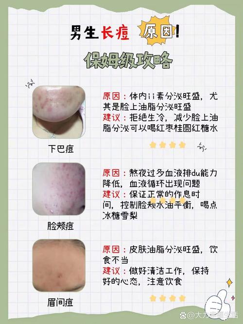 脸上长豆是什么原因