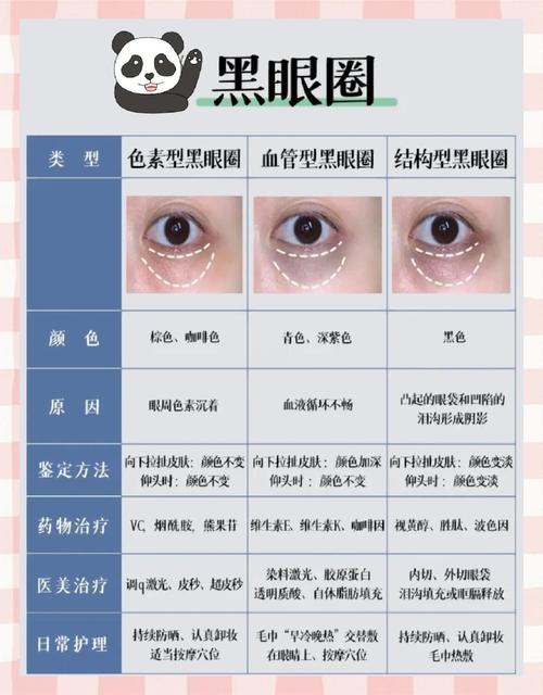 黑眼圈是什么导致的