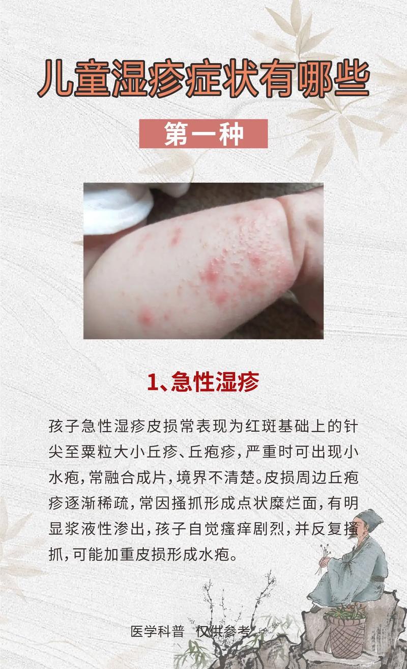 宝宝湿疹是什么引起的