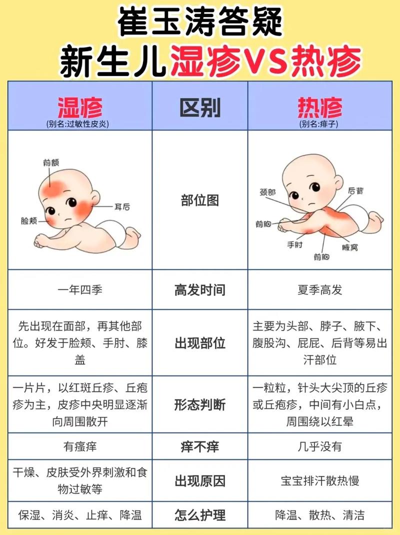 宝宝湿疹是什么引起的
