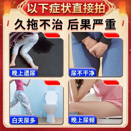 女性尿频吃什么药最好