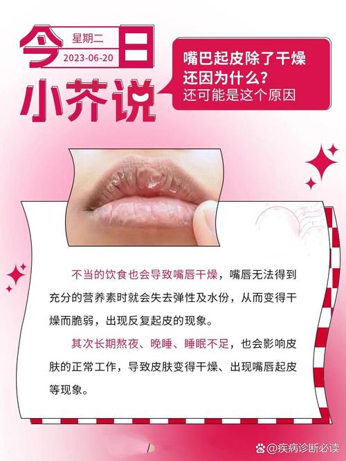 嘴皮干燥是什么原因