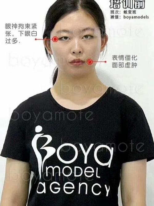 眼皮厚是什么原因