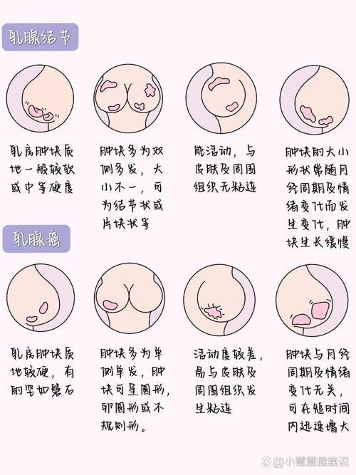 乳头为什么那么大
