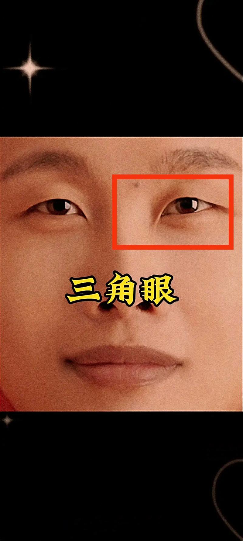 什么叫三角眼