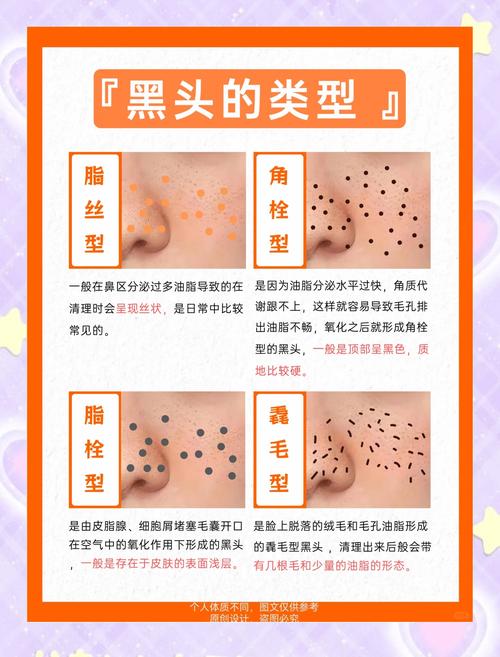脸上为什么有黑头