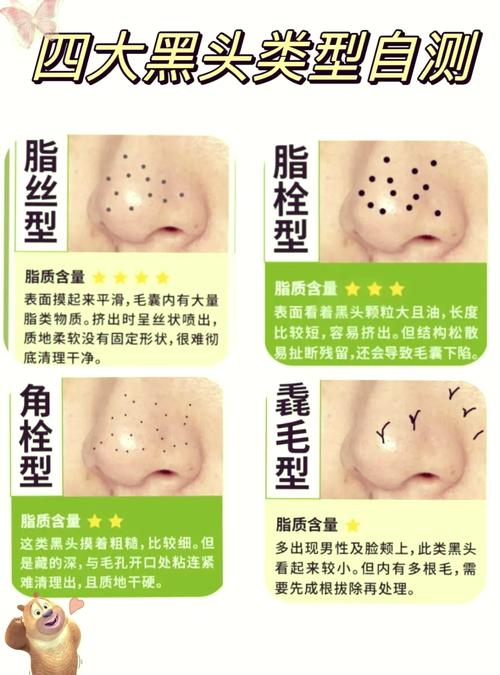脸上为什么有黑头