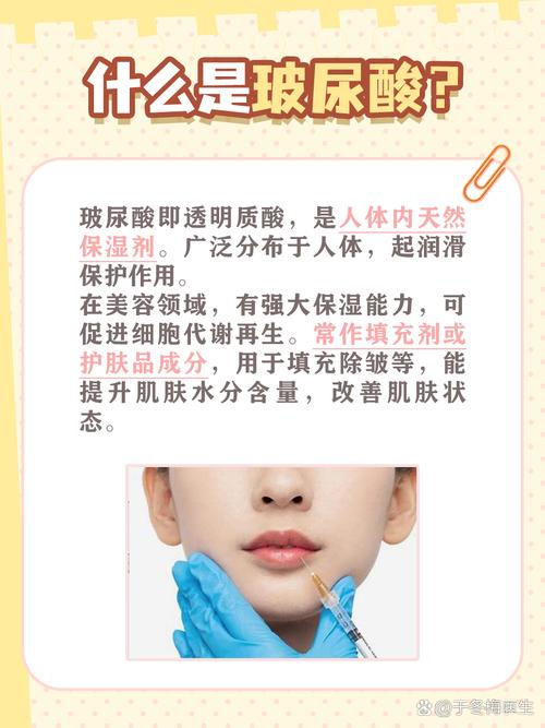玻料酸是什么