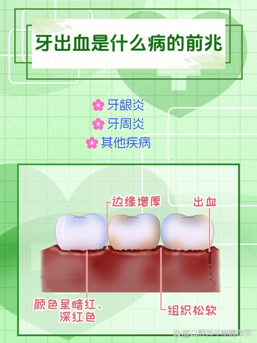 什么病会牙龈出血