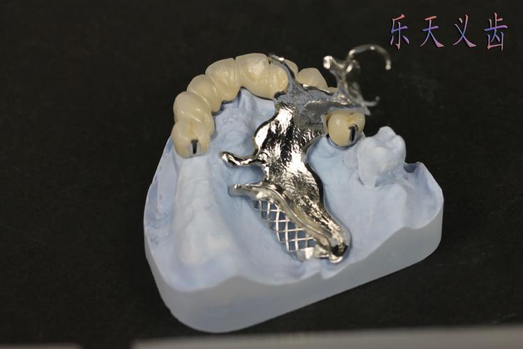 安装什么假牙好