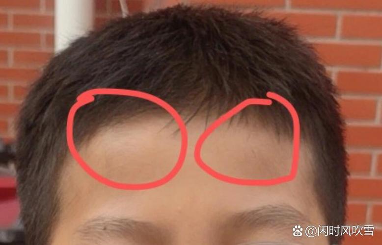 额突是什么