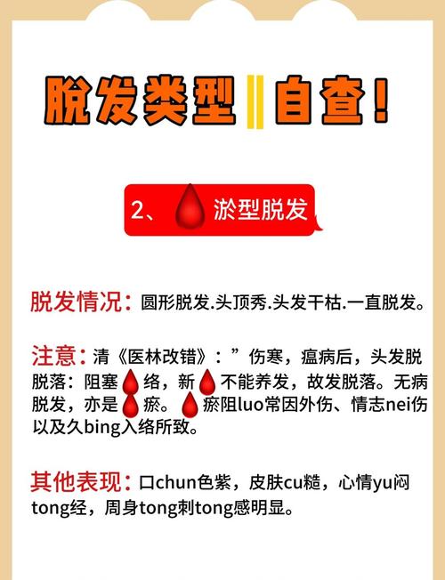 脱发属于什么科