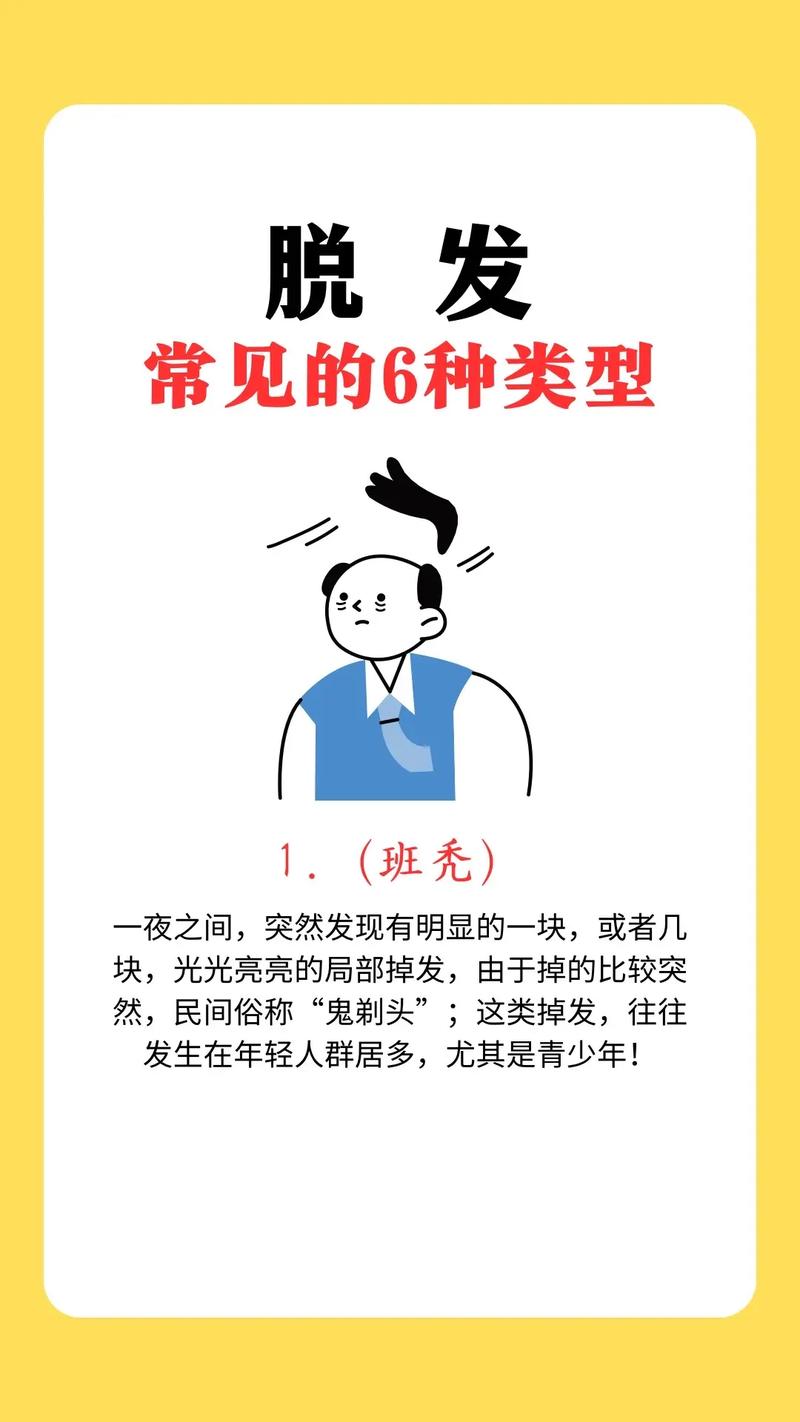 脱发属于什么科