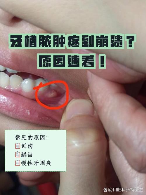 牙根发炎什么症状