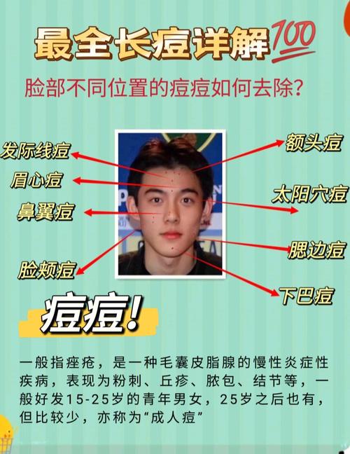男的长痘痘什么原因