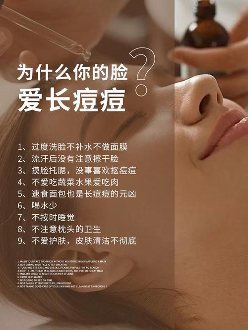 为什么脸颊会长痘痘
