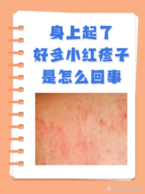 为什么皮肤总是过敏