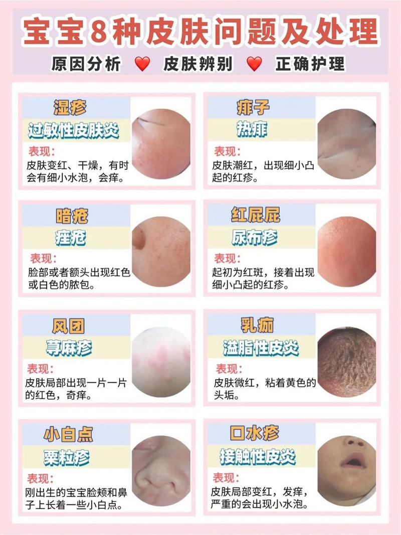 为什么皮肤总是过敏