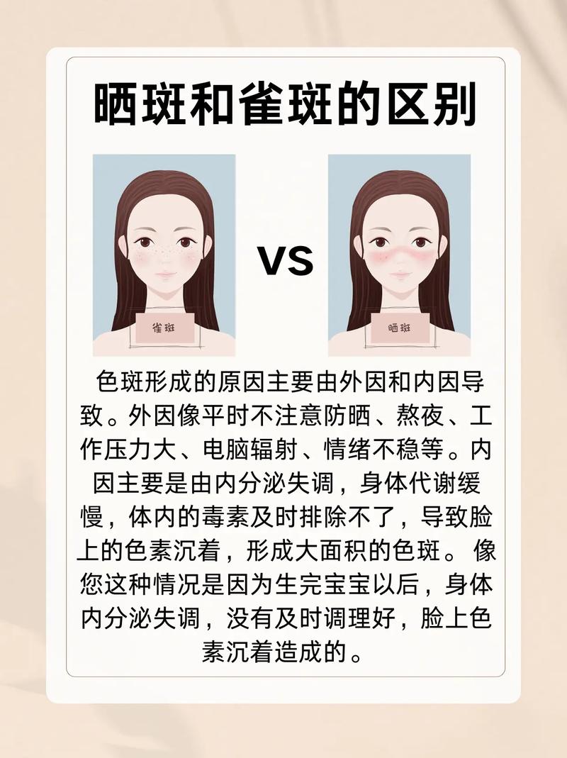 为什么会有晒斑