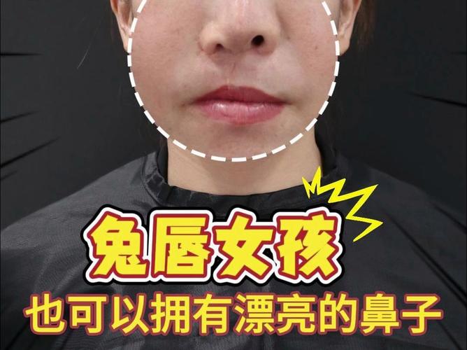 突唇是什么